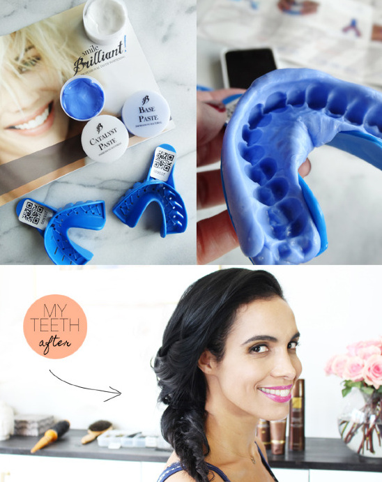 Teeth whitening kit and woman with a radiant smile after treatment