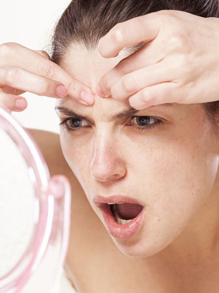 6 Tips To Help Clear Adult Acne From An Acne Survivor